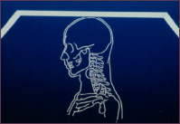 Illustration of neck injuries in a car accident